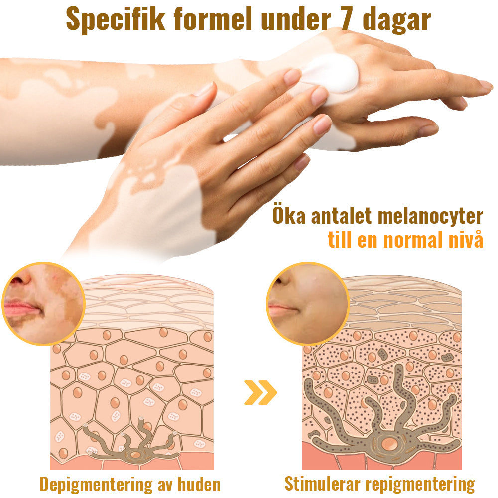 Dobshow™ BeeVenom Vitiligo Treatment Cream