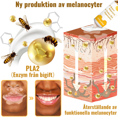 Dobshow™ BeeVenom Vitiligo Treatment Cream