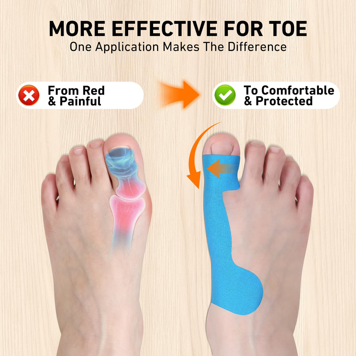 Kinesiology Tape for Hallux Valgus (Bunions) – Wearable Under Shoes, Provides Correction and Support